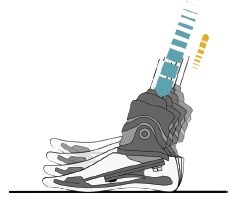 Figure 1: Relief Function of a Microprocessor Foot (source: oandp.org)