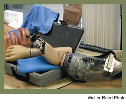 Prosthetic Devices for Upper-Extremity Amputees 02