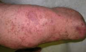 Skin Issues Lower img 02