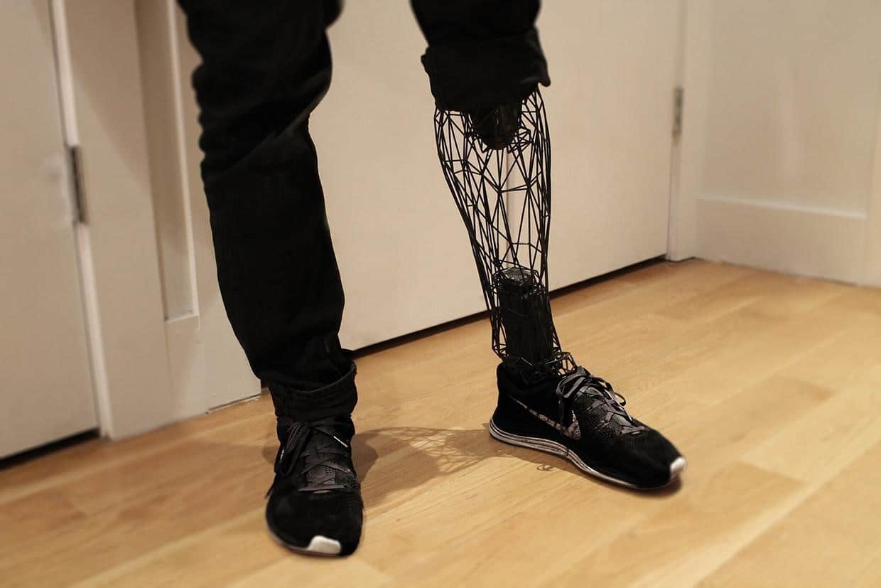 Lower limb amputee with a 3D wire mesh hollow prosthetic.
