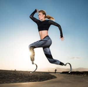 Amy Purdy running on prosthetic legs.